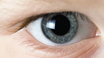 Göz Kapağı Titremesi Belirtileri ve Tedavisi